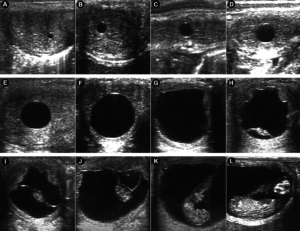 Camargo et al., 2020 Ultrasonografías de útero en trasplante de embrión de caballos en una mula receptora.