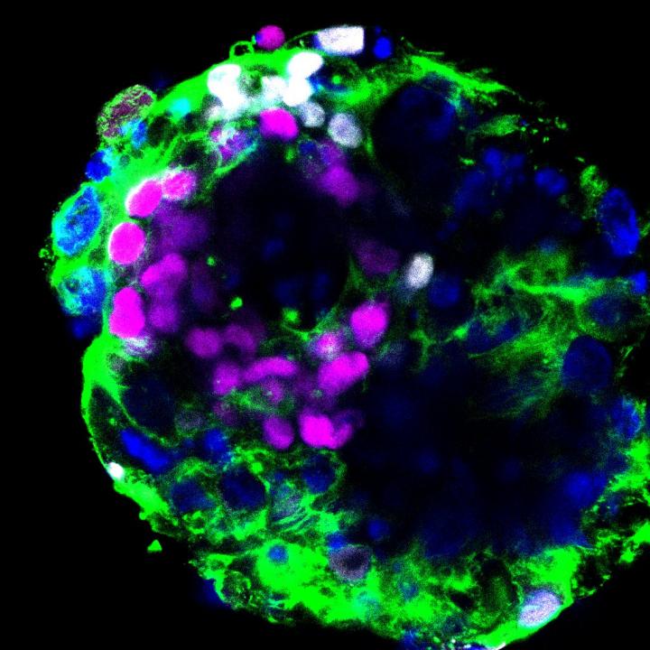 Embrión Humano COVID-19
